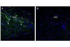 Expression of Oxytocyn Receptor in rat midbrain.