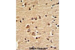 Immunohistochemistry (IHC) image for anti-Engrailed Homeobox 2 (EN2) antibody (ABIN3003224)