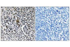 Immunohistochemistry (IHC) image for anti-Ribosomal Protein S3 (RPS3) (C-Term) antibody (ABIN1850588) (RPS3 anticorps  (C-Term))
