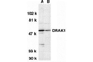 Western Blotting (WB) image for anti-serine/threonine Kinase 17a (STK17A) (N-Term) antibody (ABIN1031360) (STK17A anticorps  (N-Term))