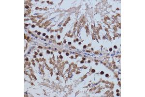 Immunohistochemistry of paraffin-embedded rat testis using BRD4 antibody (ABIN6127508, ABIN6137653, ABIN6137654 and ABIN7101457) at dilution of 1:100 (40x lens). (BRD4 anticorps  (AA 1100-1200))