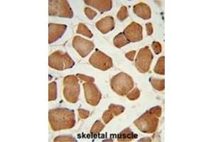 Formalin-fixed and paraffin-embedded human skeletal muscle reacted with ANGPTL4 Antibody (Center), which was peroxidase-conjugated to the secondary antibody, followed by DAB staining.