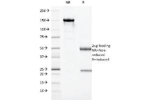 SDS-PAGE Analysis Purified HLA-DRA Monoclonal Antibody (19-26. (HLA-DRA anticorps)