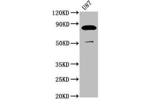 Western Blot Positive WB detected in: U87 whole cell lysate All lanes: FRMD7 antibody at 3. (FRMD7 anticorps  (AA 464-617))