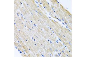 Immunohistochemistry of paraffin-embedded mouse heart using ABCB8 antibody (ABIN5974712) at dilution of 1/100 (40x lens). (ABCB8 anticorps)