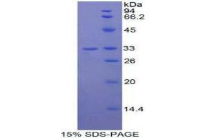 SDS-PAGE (SDS) image for Jagged 2 (JAG2) (AA 714-981) protein (His-GST) (ABIN2125514) (JAG2 Protein (AA 714-981) (His-GST))