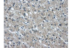 Immunohistochemical staining of paraffin-embedded liver tissue using anti-HDAC10mouse monoclonal antibody. (HDAC10 anticorps)