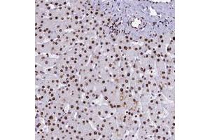 Immunohistochemical staining of human liver with SRRM2 polyclonal antibody  shows strong nuclear positivity in hepatocytes. (SRRM2 anticorps)