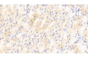 Detection of MIg in Mouse Kidney Tissue using Polyclonal Antibody to Monokine Induced By Interferon Gamma (MIg)