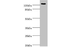 Western blot All lanes: NLRP2 antibody at 12 μg/mL + A431 whole cell lysate Secondary Goat polyclonal to rabbit IgG at 1/10000 dilution Predicted band size: 121, 119, 97, 118 kDa Observed band size: 121 kDa (NLRP2 anticorps  (AA 1-220))
