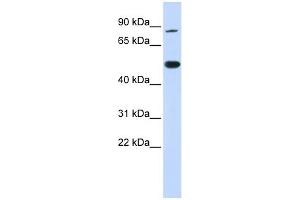 WB Suggested Anti-TRMT1 Antibody Titration:  0. (TRMT1 anticorps  (N-Term))