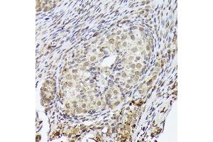 Immunohistochemistry of paraffin-embedded rat ovary using PSMD14 Rabbit mAb (ABIN7269588) at dilution of 1:100 (40x lens).