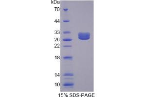 Image no. 1 for Phospholipase C gamma 2 (PLCG2) (AA 930-1152) protein (His tag) (ABIN6237012) (Phospholipase C gamma 2 Protein (PLCG2) (AA 930-1152) (His tag))