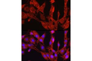 Immunofluorescence analysis of PC-12 cells using Proprotein Convertase 9(PCSK9) Rabbit pAb (ABIN6133851, ABIN6145328, ABIN6145330 and ABIN6223837) at dilution of 1:250 (40x lens).