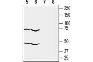 Western blot analysis of human ovary adenocarcinoma OVCAR-3 cell (lanes 5 and 7) and human pancreatic carcinoma PANC-1 cell (lanes 6 and 8) lysates: - 5, 6.
