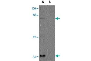 Western blot analysis of NAA35 in rat heart tissue lysate with NAA35 polyclonal antibody  at 1 ug/mL in the (A) absence and (B) presence of blocking peptide.