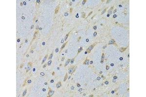 Immunohistochemistry of paraffin-embedded Mouse brain using DARS Polyclonal Antibody at dilution of 1:100 (40x lens).