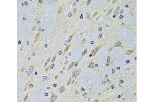 Immunohistochemistry of paraffin-embedded Mouse brain using DARS Polyclonal Antibody at dilution of 1:100 (40x lens). (DARS anticorps)