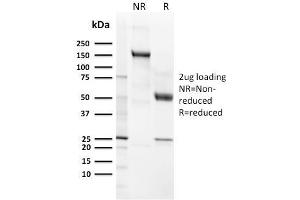 SDS-PAGE Analysis Purified CD21 / CR2 Recombinant Rabbit Monoclonal Antibody (CR2/3124R). (Recombinant CD21 anticorps  (AA 142-240))
