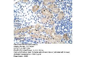 Rabbit Anti-RNASEH2A Antibody  Paraffin Embedded Tissue: Human Kidney Cellular Data: Epithelial cells of renal tubule Antibody Concentration: 4. (RNASEH2A anticorps  (Middle Region))