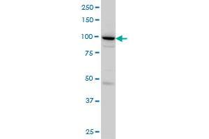 SH3D19 monoclonal antibody (M01), clone 5C7 Western Blot analysis of SH3D19 expression in HeLa .
