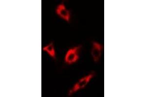 Immunofluorescent analysis of MsrA staining in U2OS cells. (MSRA anticorps)