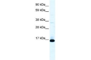 WB Suggested Anti-TCF21 Antibody Titration:  0. (TCF21 anticorps  (N-Term))