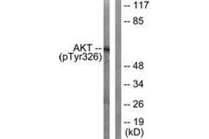 Western blot analysis of extracts from mouse liver, using Akt (Phospho-Tyr326) Antibody. (AKT1 anticorps  (pTyr326))