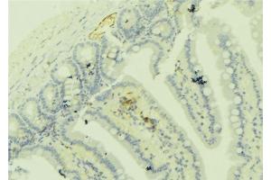 ABIN6279274 at 1/100 staining Mouse colon tissue by IHC-P. (Centriolin anticorps)