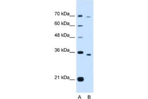 Western Blotting (WB) image for anti-PHD Finger Protein 6 (PHF6) antibody (ABIN2463418) (PHF6 anticorps)