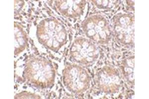 Immunohistochemistry of TEM1 in human colon tissue with this product at 2.