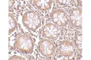 Immunohistochemistry of TEM1 in human colon tissue with this product at 2. (CD248 anticorps  (N-Term))