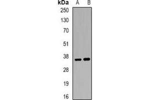 Western blot analysis of ACP5 expression in Jurkat (A), BT474 (B) whole cell lysates.