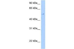 WB Suggested Anti-TERF2 Antibody Titration: 5. (TRF2 anticorps  (C-Term))
