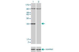 Western blot analysis of HOXB7 over-expressed 293 cell line, cotransfected with HOXB7 Validated Chimera RNAi (Lane 2) or non-transfected control (Lane 1). (HOXB7 anticorps  (AA 55-120))