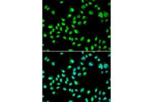 Immunofluorescence analysis of A549 cells using GTF2F2 antibody. (GTF2F2 anticorps  (AA 1-249))