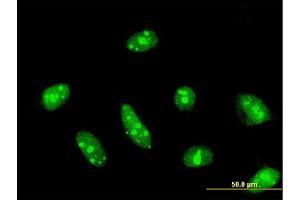 Immunofluorescence of monoclonal antibody to CDC14A on HeLa cell.