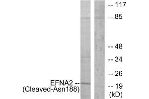 Western blot analysis of extracts from 293 cells, treated with etoposide (25uM, 1hour), using EFNA2 (Cleaved-Asn188) antibody. (Ephrin A2 anticorps  (Cleaved-Asn188))