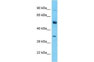 Host:  Rabbit  Target Name:  ALX3  Sample Type:  Thymus Tumor lysates  Antibody Dilution:  1.