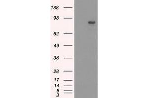 Western Blotting (WB) image for anti-SATB Homeobox 1 (SATB1) antibody (ABIN1500810)