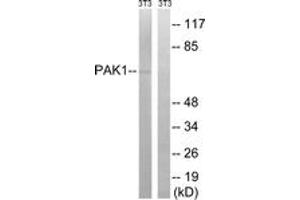 Western blot analysis of extracts from NIH-3T3 cells, treated with UV 15', using PAK1 (Ab-204) Antibody. (PAK1 anticorps  (AA 170-219))
