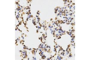 Immunohistochemistry of paraffin-embedded rat lung using DiMethyl-Histone H3-K9 antibody.
