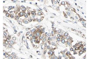 ABIN6267044 at 1/100 staining human Lung tissue sections by IHC-P. (NF-kB p65 anticorps  (C-Term))