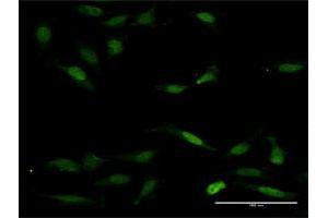 Immunofluorescence of purified MaxPab antibody to NFAT5 on HeLa cell.