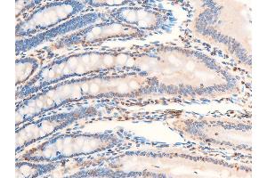 ABIN6267286 at 1/100 staining rat intestinal tissue sections by IHC-P.