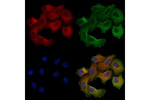 ABIN6257099 and ABIN6275623 staining Hela cells by IF/ICC. (CCT5 anticorps  (Internal Region))