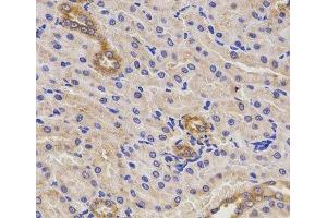 Immunohistochemistry of paraffin-embedded Rat kidney using TNFRSF1B Polyclonal Antibody at dilution of 1:200 (40x lens). (TNFRSF1B anticorps)