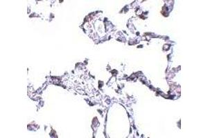 Immunohistochemistry (IHC) image for anti-CD81 (CD81) (N-Term) antibody (ABIN1031309) (CD81 anticorps  (N-Term))