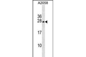 CHCHD6 Antibody (Center) (ABIN1537835 and ABIN2849408) western blot analysis in  cell line lysates (35 μg/lane). (CHCHD6 anticorps  (AA 136-165))
