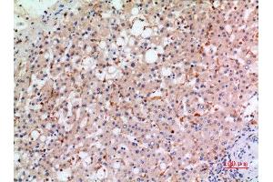 Immunohistochemistry (IHC) analysis of paraffin-embedded Human Liver, antibody was diluted at 1:100. (CYBB anticorps  (Internal Region))